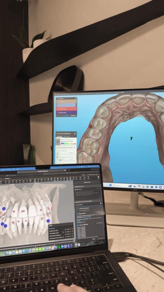 planejamento-invisalign